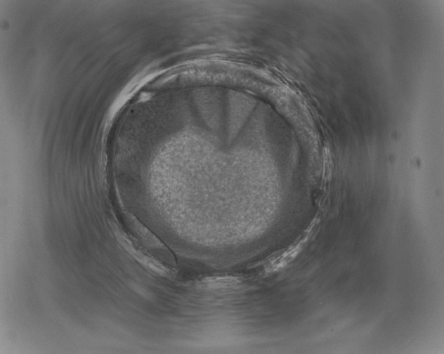 X0000079280150200612081802