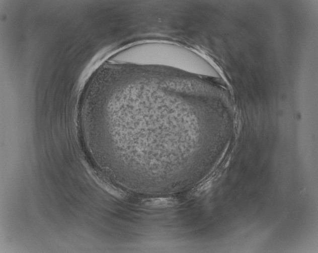 X0000079280151200612081802