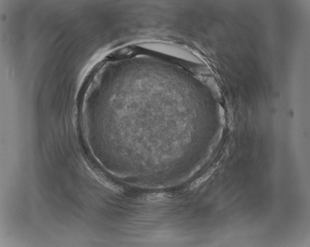 X0000079280152200612081802