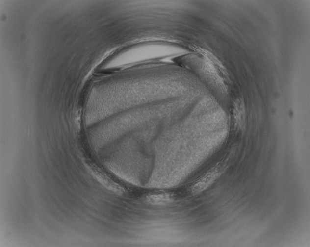 X0000079280160200612081802