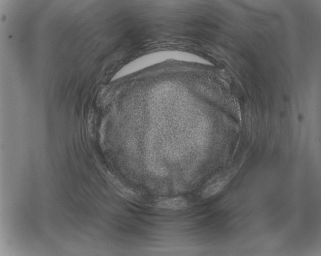 X0000079280185200612081802