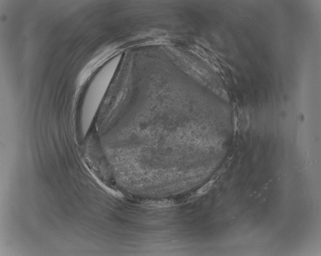 X0000079280245200612081800