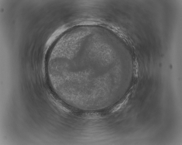 X0000079280296200612081800