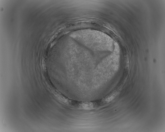 X0000079280317200612081800