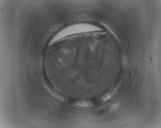 X0000079280451200612081757