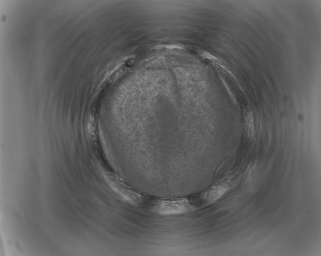 X0000079280571200612081756