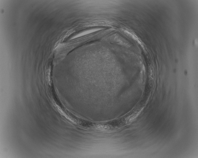 X0000079280585200612081755