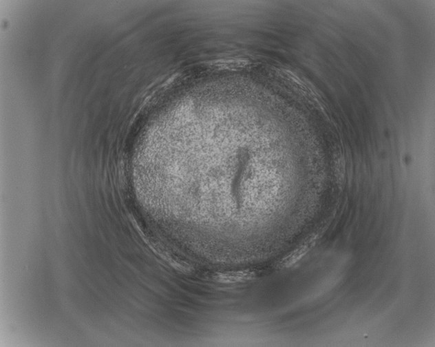 X0000079280757200612081753