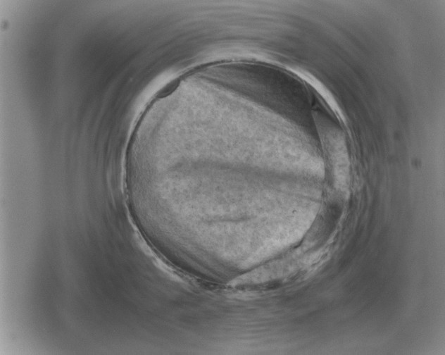 X0000079280815200612081751