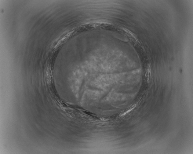 X0000079281014200612081748