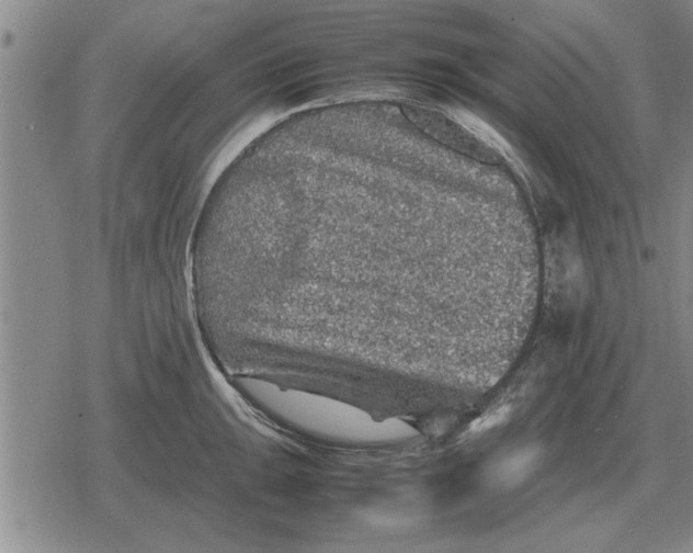 X0000079281047200612081748