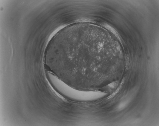 X0000079281141200612081746