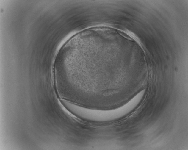 X0000079281151200612081747