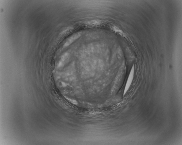 X0000079281153200612081746