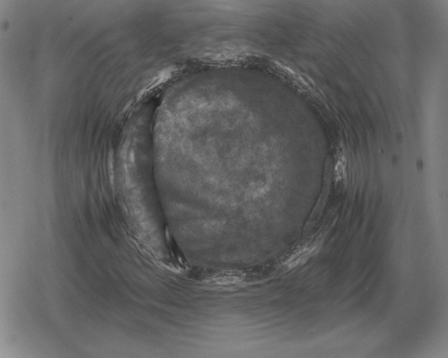 X0000079281156200612081746