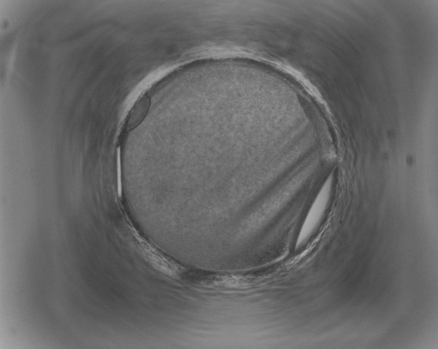 X0000079281175200612081746