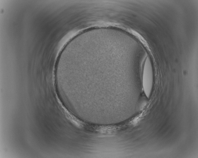 X0000079281183200612081745