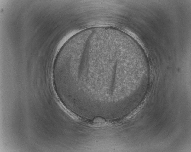 X0000079281187200612081745