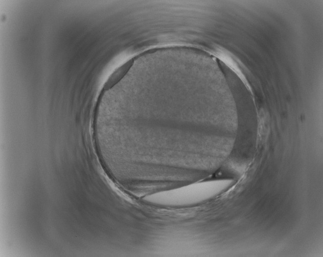 X0000079281197200612081745