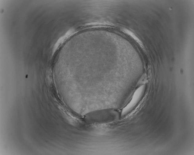 X0000079281357200612081743