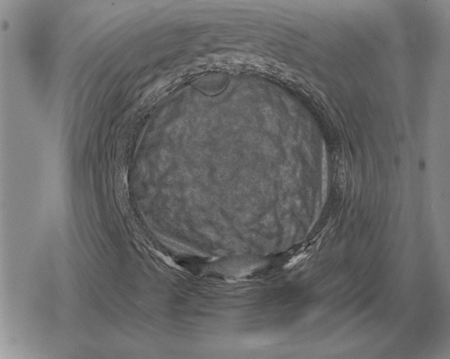 X0000079281489200612081740