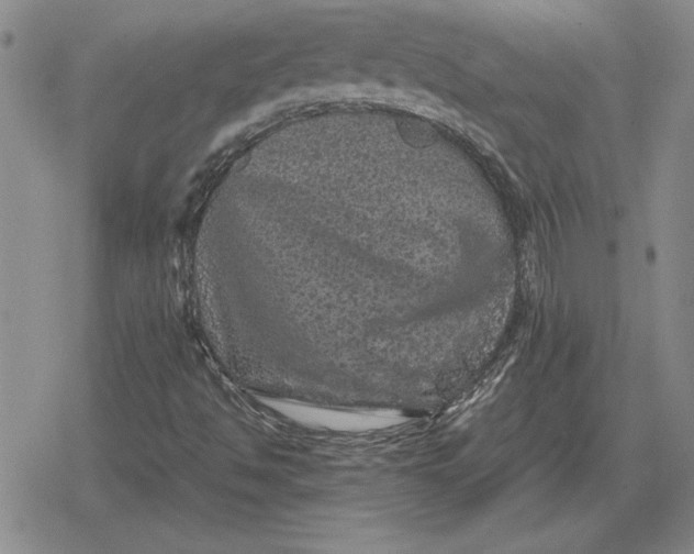 X0000079281494200612081740