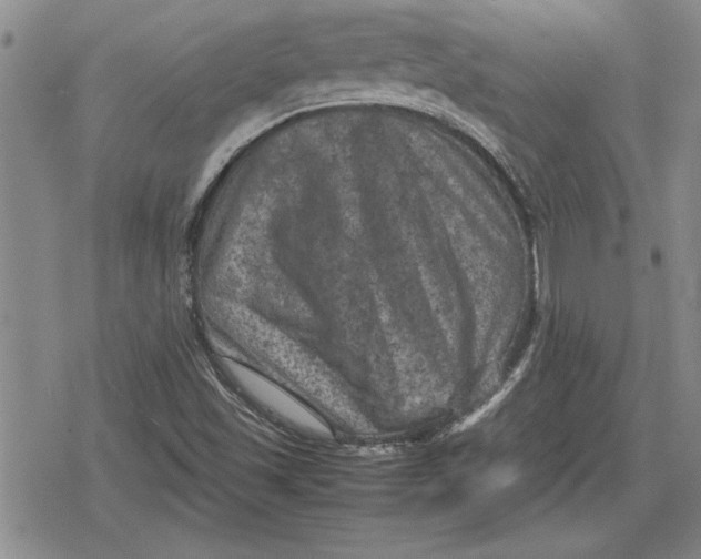 X0000079281501200612081740