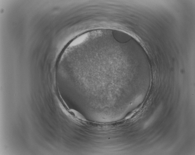 X0000079281515200612081740