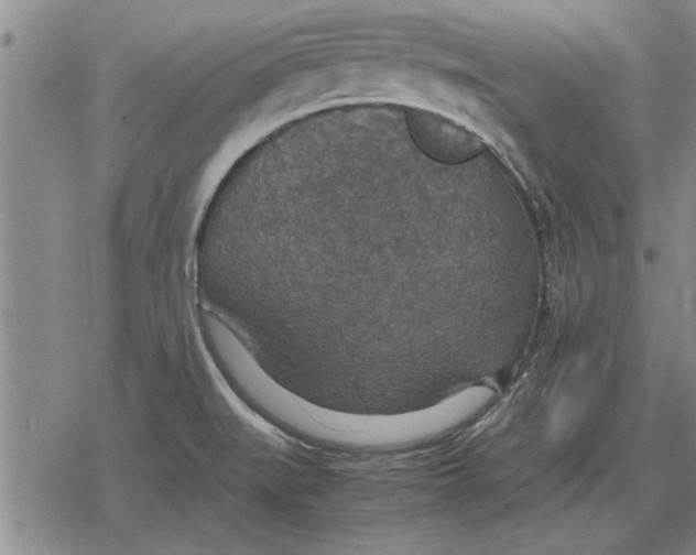 X0000079281519200612081740