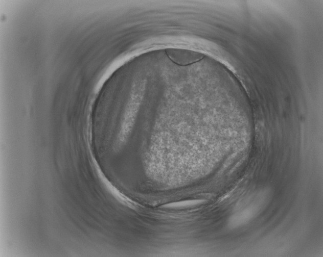 X0000079281523200612081740