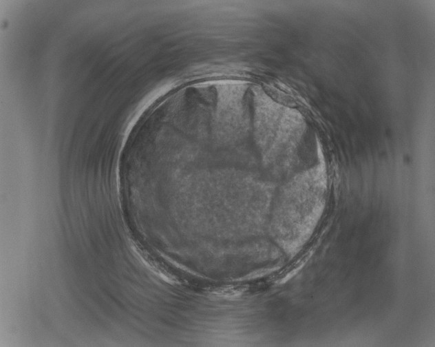 X0000079280148200612151645