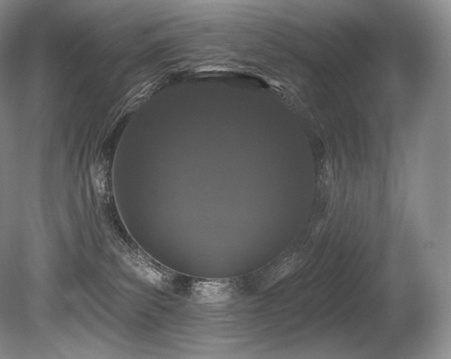 X0000079290139200611171101