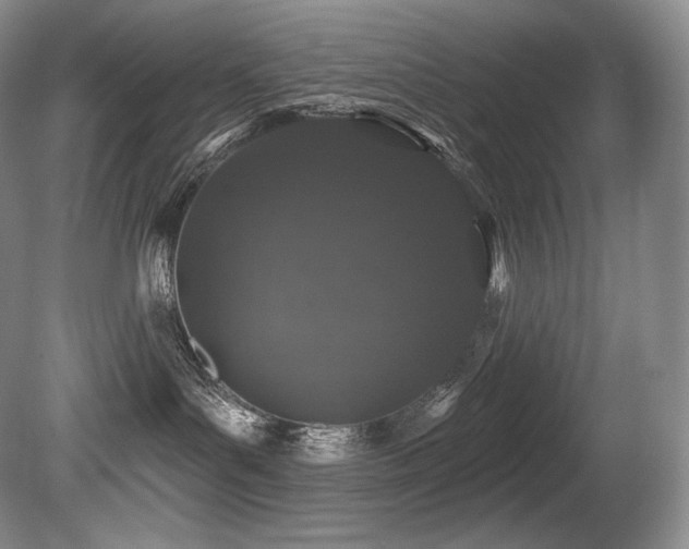 X0000079290143200611171101