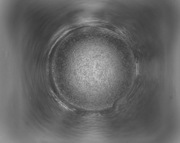 X0000079290243200611171058