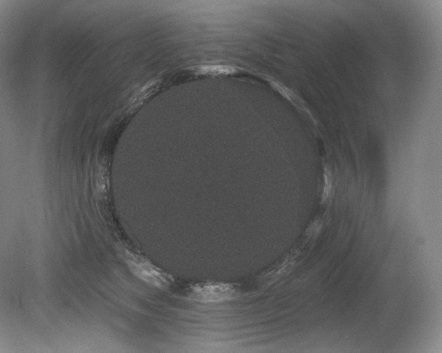 X0000079290517200611171054