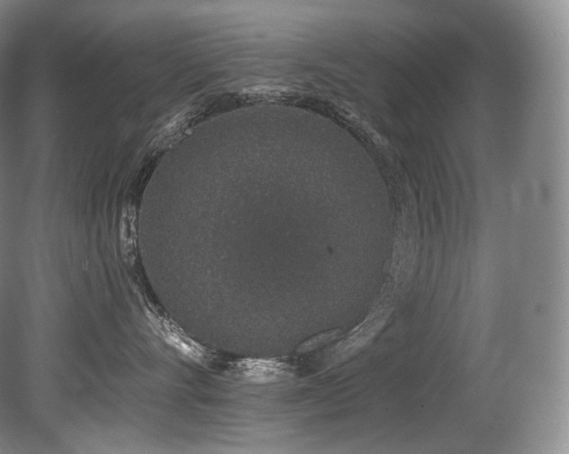 X0000079290528200611171054