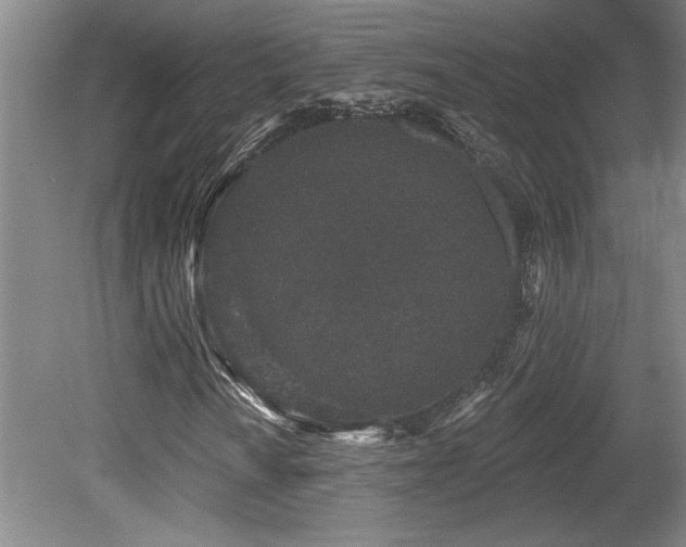 X0000079291010200611171045