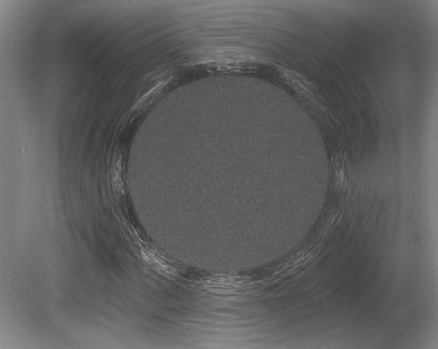 X0000079291060200611171045