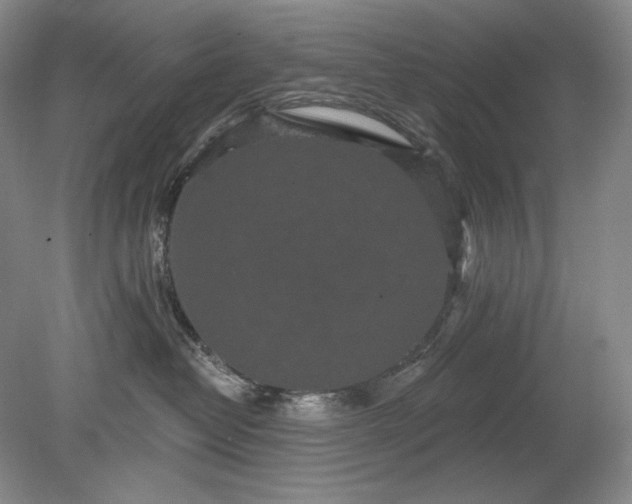 X0000079290382200612011730