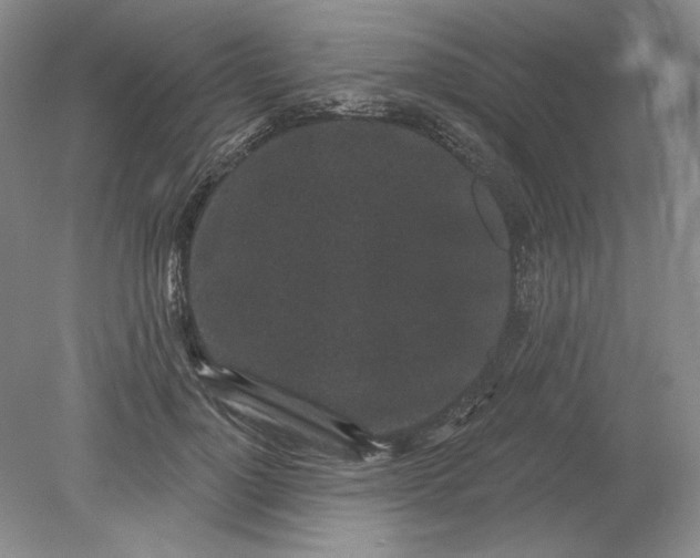 X0000079290748200612011723