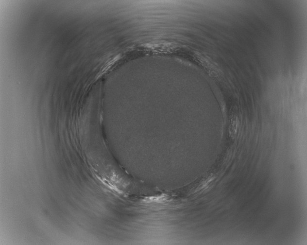 X0000079291010200612011718