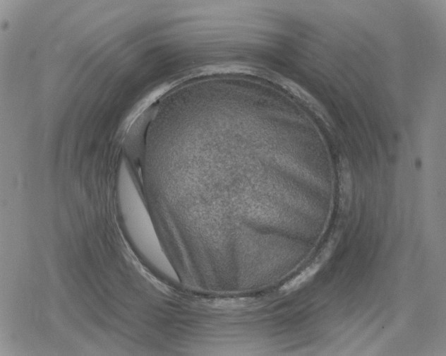X0000079290985200612081814