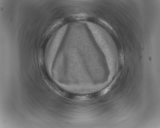 X0000079290170200612151711