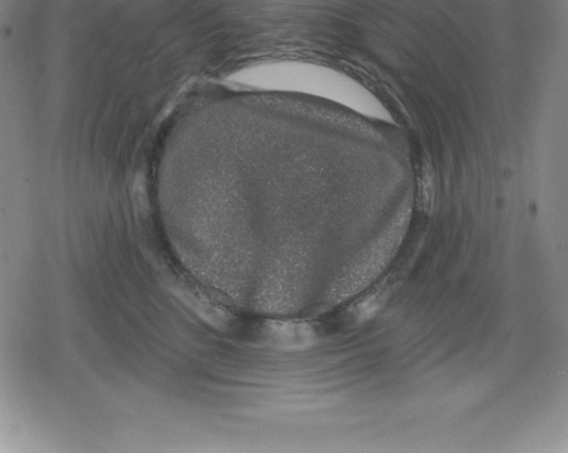 X0000079290520200612151705