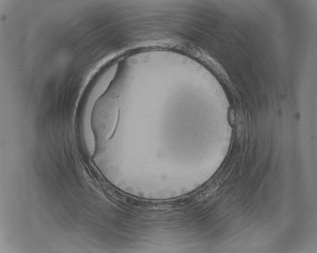 X0000079290628200612151703