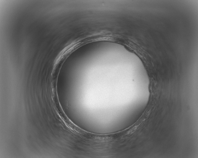 X0000079300245200611170836