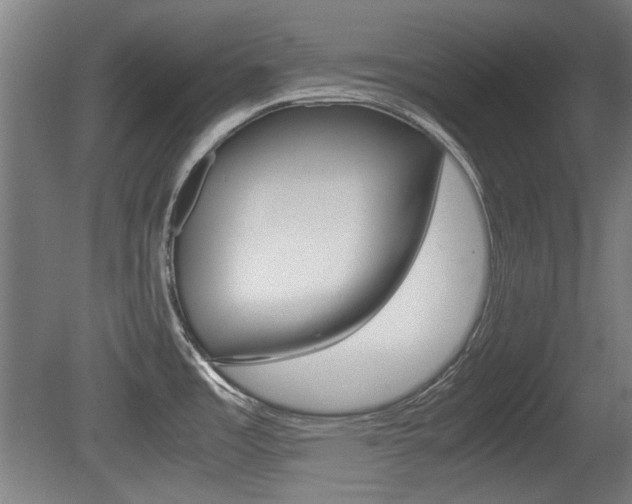X0000079301485200611170816