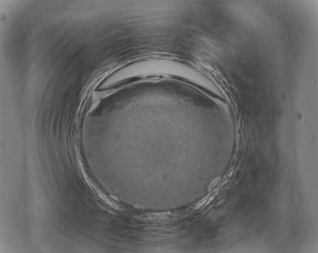 X0000079300049200611171041