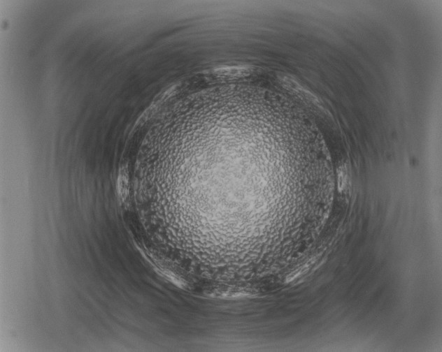 X0000079301011200611171025