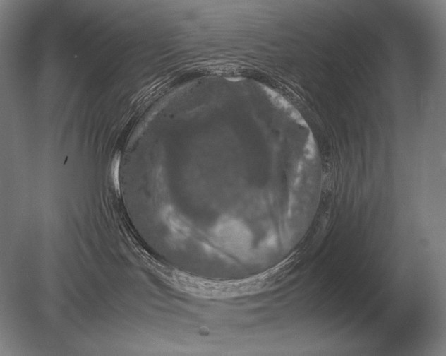 X0000079300047200612011801